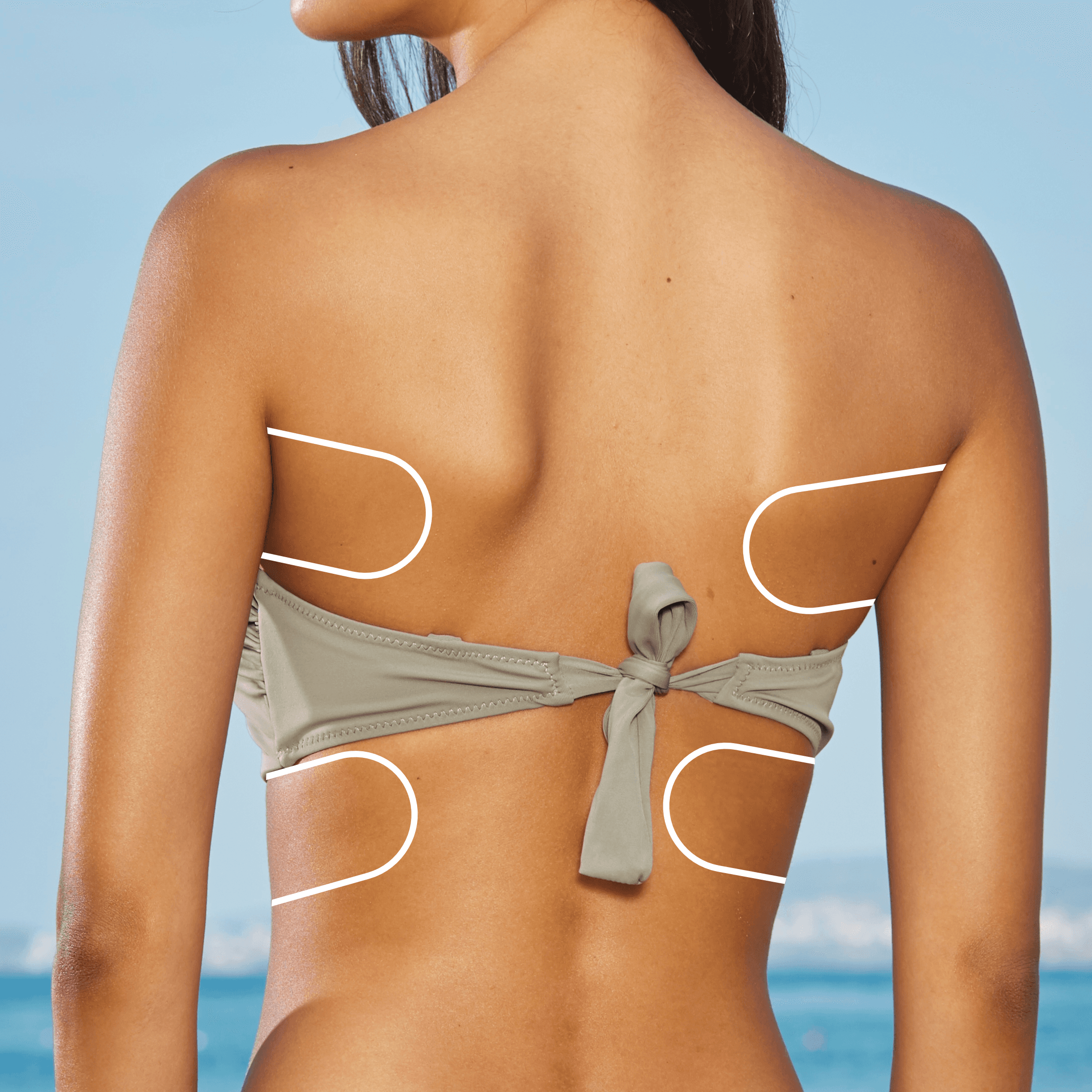 Consultation and treatment planning